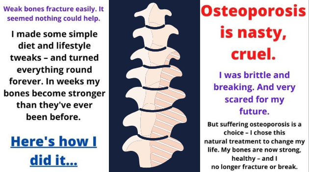 osteoporosis MarketShoppy Texas Florida California USA