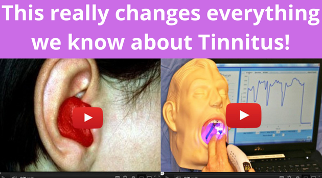 Sonus Complete Tinnitus Solution Medicine California Texas USA